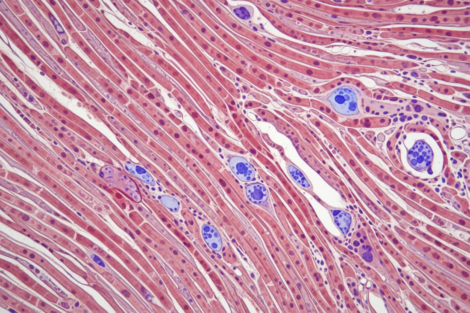 Magnified view of muscle fibers with micro-tears - lactic acid in legs