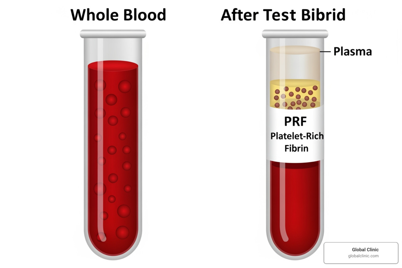 Illustration of the difference between whole blood and PRF - are prf injections safe