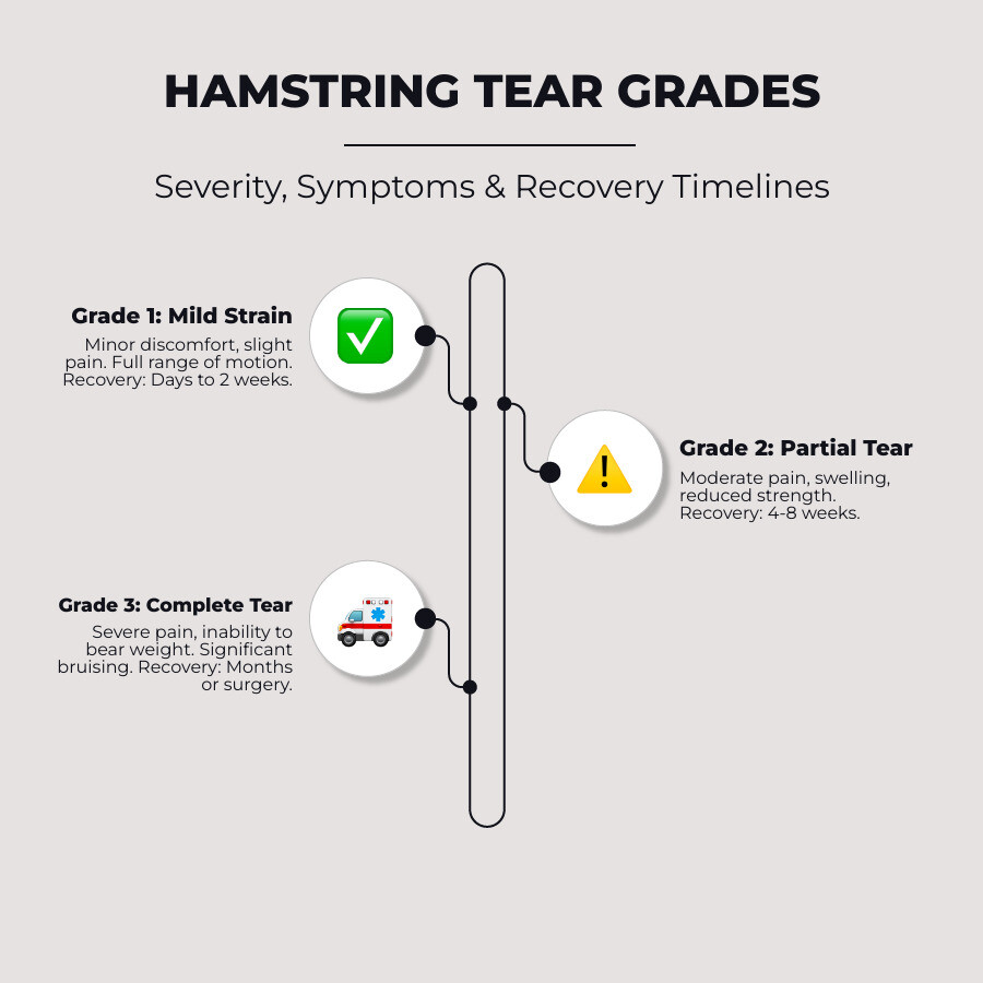 infographic showing three grades of hamstring tears with severity levels, symptoms, and recovery timelines for each grade - exercises for a torn hamstring infographic infographic-line-3-steps-elegant_beige
