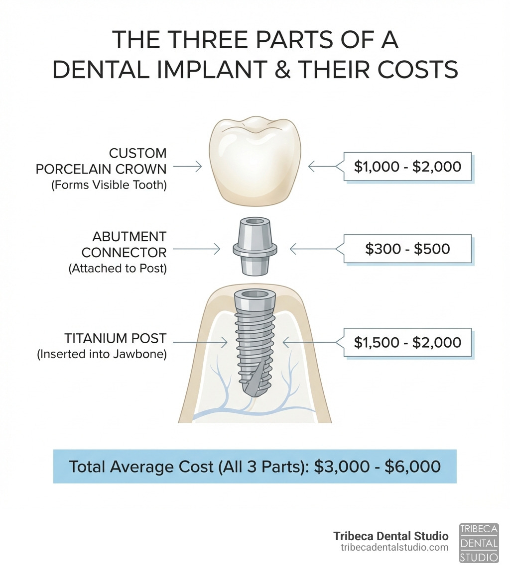 Infographic explaining the three parts of a dental implant: the titanium post inserted into the jawbone, the abutment connector piece attached to the post, and the custom porcelain crown that forms the visible tooth, with cost ranges for each component - how much 1 tooth implant cost infographic 
