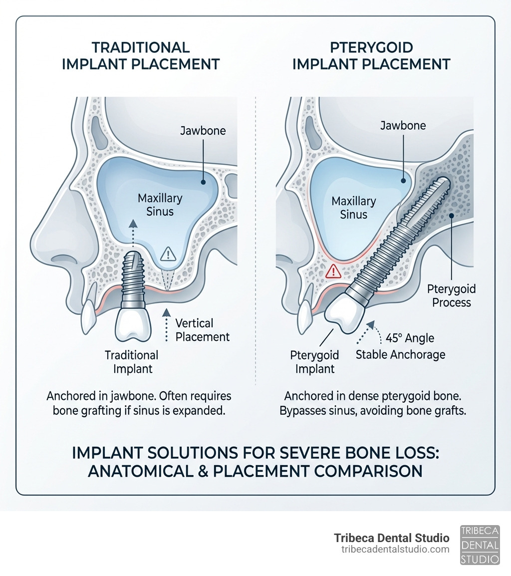 infographic showing traditional implant placement vertically in jawbone versus pterygoid implant placement at 45-degree angle into pterygoid bone, with labels for maxillary sinus, jawbone, and pterygoid process - pterygoid dental implants infographic 