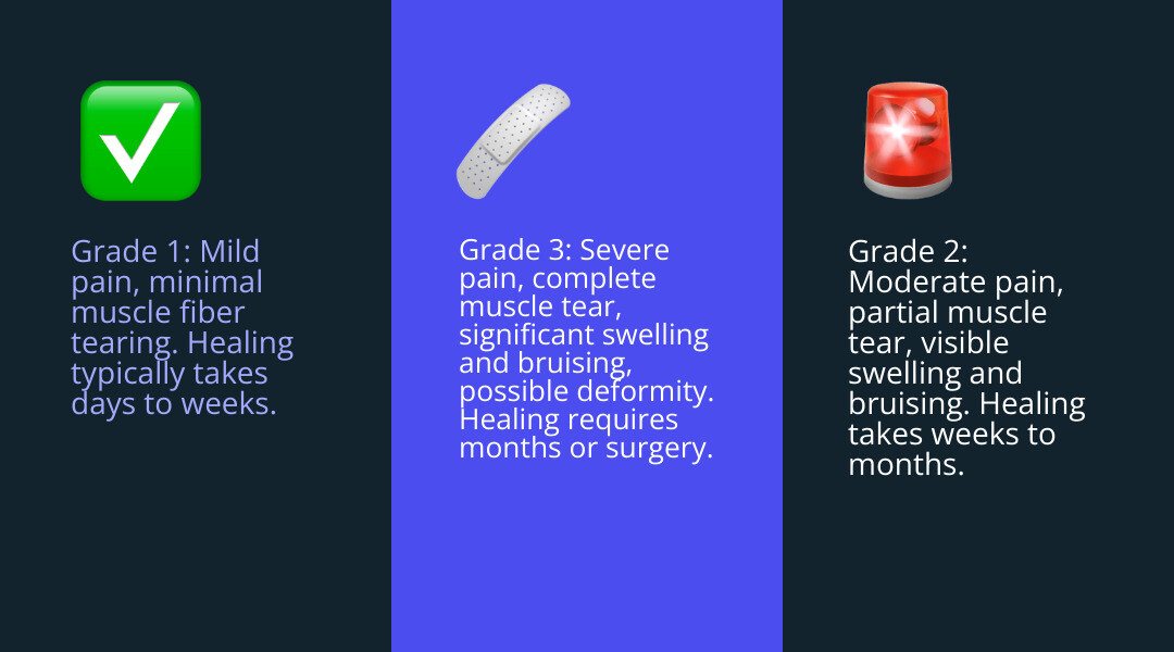 Infographic showing the three grades of hamstring injury: Grade 1 with mild pain and minimal tearing, healing in days to weeks; Grade 2 with moderate pain, partial muscle tear, visible swelling and bruising, healing in weeks to months; Grade 3 with severe pain, complete muscle tear, significant swelling and bruising, possible visible deformity, healing requiring months or surgery - pulled muscle at back of thigh infographic 3_facts_emoji_blue