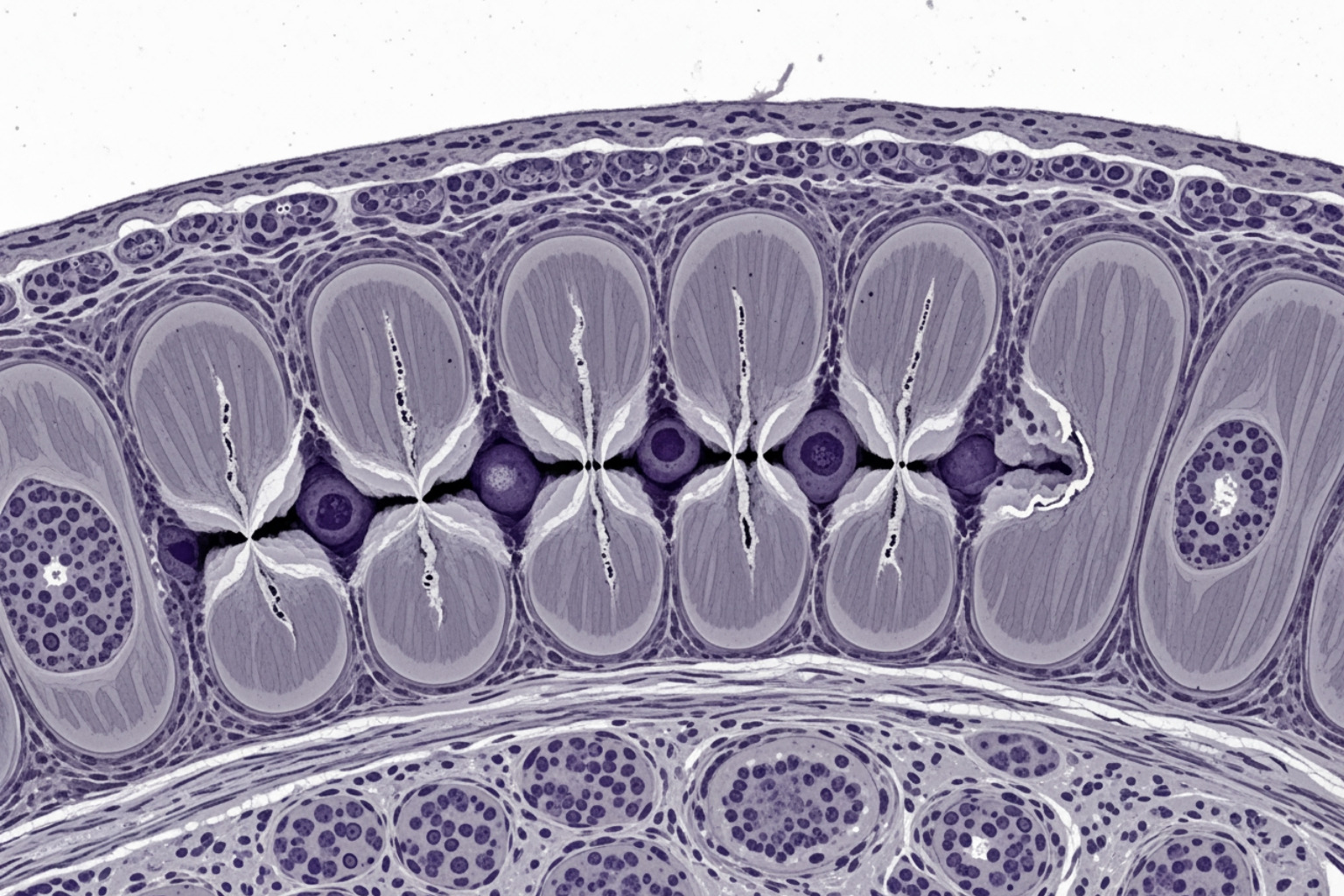 microscopic view of muscle fibers showing micro-tears - working out with doms