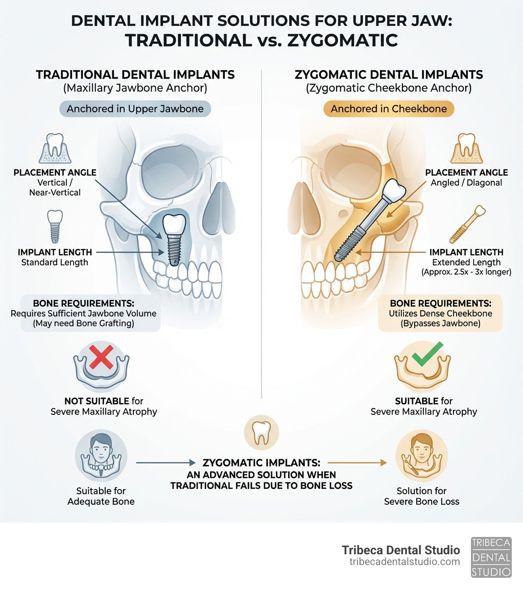 Infographic comparing traditional dental implants anchored in the upper jawbone versus zygomatic dental implants anchored in the cheekbone, showing the difference in placement angle, implant length, bone requirements, and suitability for patients with severe maxillary atrophy - Zygomatic dental implants infographic 