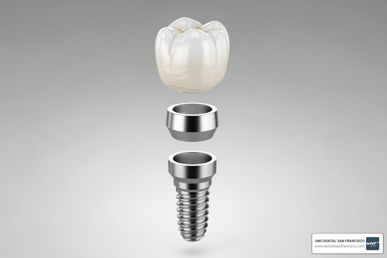 Image of the different components of a dental implant (post, abutment, crown) - Dental implant cost calculator Image of the different components of a dental implant (post, abutment, crown) - Dental implant cost calculator