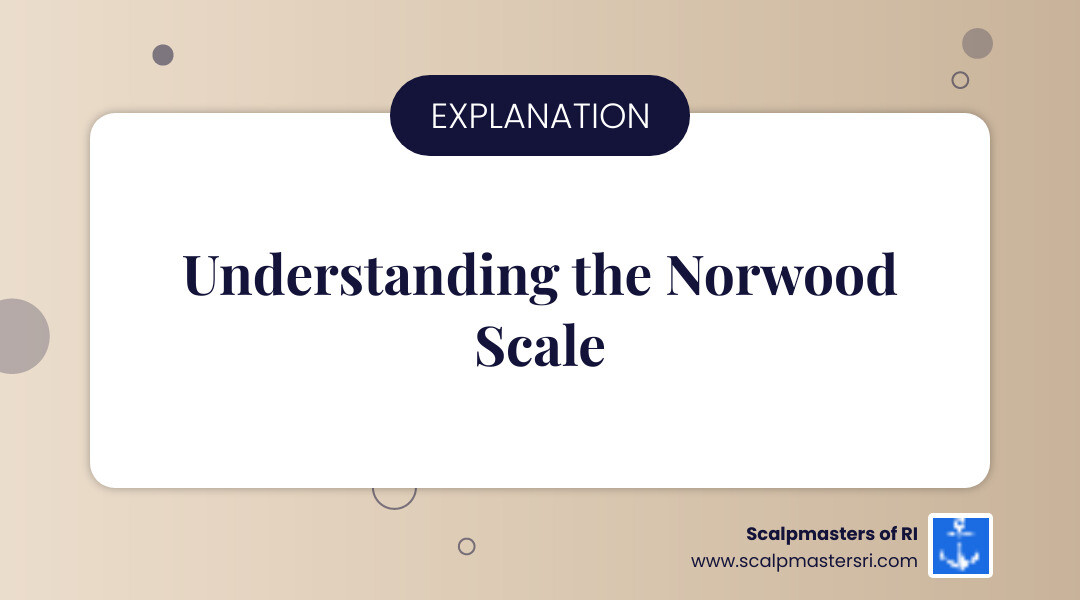 Infographic showing the 7 stages of the Norwood Scale for male pattern baldness, from minimal temple recession in Stage 1 to severe hair loss with only a band of hair remaining around the sides and back in Stage 7 - receding hairline solutions infographic simple-info-landscape-card
