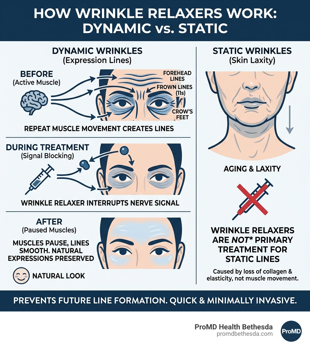 Infographic showing how wrinkle relaxers work on dynamic wrinkles versus static wrinkles, including the difference between expression lines (crow's feet, forehead lines, frown lines) and wrinkles caused by skin laxity, with visual representation of muscle movement and nerve signal blocking - Wrinkle relaxers Bethesda infographic 