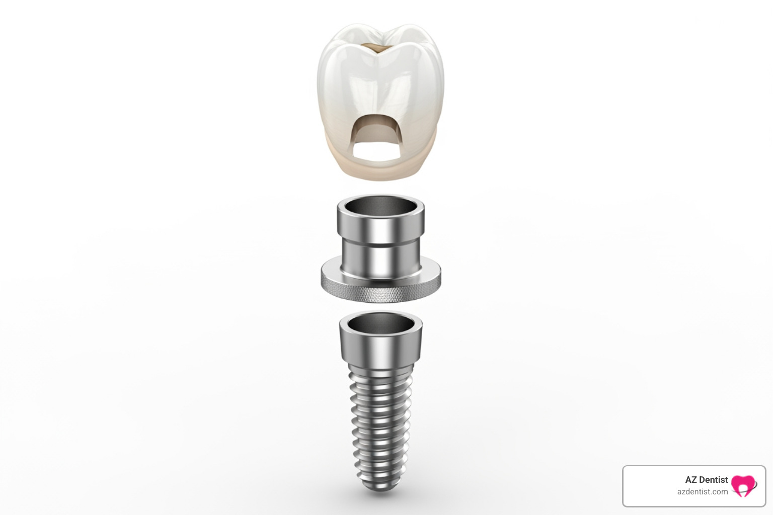 A diagram showing the three components of a dental implant: the screw-like implant post, the small connecting abutment, and the tooth-shaped crown. - cost of dental implants A diagram showing the three components of a dental implant: the screw-like implant post, the small connecting abutment, and the tooth-shaped crown. - cost of dental implants