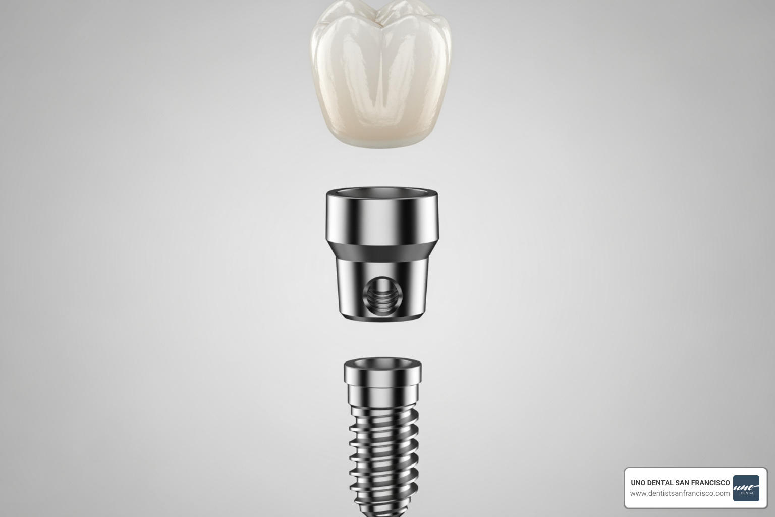 three parts of a dental implant: fixture, abutment, and crown - Dental implant cost SF three parts of a dental implant: fixture, abutment, and crown - Dental implant cost SF