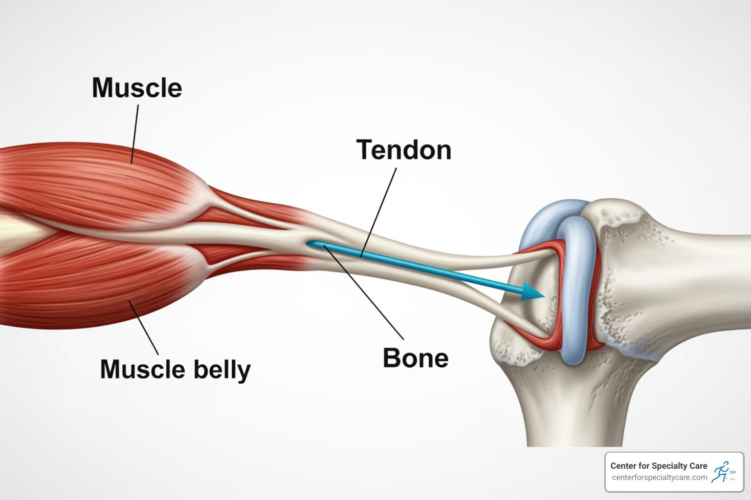 diagram showing tendon connecting muscle to bone - Is heat good for tendonitis