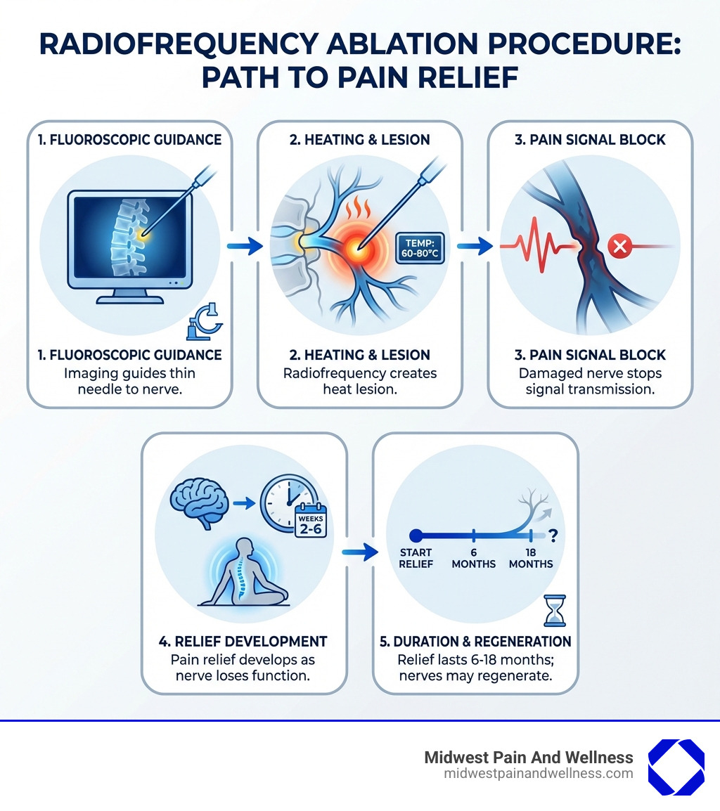 Detailed infographic showing the radiofrequency ablation procedure: 1) Fluoroscopic imaging guides a thin needle to the targeted nerve near the facet joint, 2) Radiofrequency energy heats the nerve tissue to 60-80°C, creating a small lesion, 3) The damaged nerve can no longer transmit pain signals to the brain, 4) Pain relief develops over 2-6 weeks as the nerve loses function, 5) Relief typically lasts 6-18 months before nerves may regenerate - radiofrequency ablation infographic Detailed infographic showing the radiofrequency ablation procedure: 1) Fluoroscopic imaging guides a thin needle to the targeted nerve near the facet joint, 2) Radiofrequency energy heats the nerve tissue to 60-80°C, creating a small lesion, 3) The damaged nerve can no longer transmit pain signals to the brain, 4) Pain relief develops over 2-6 weeks as the nerve loses function, 5) Relief typically lasts 6-18 months before nerves may regenerate - radiofrequency ablation infographic