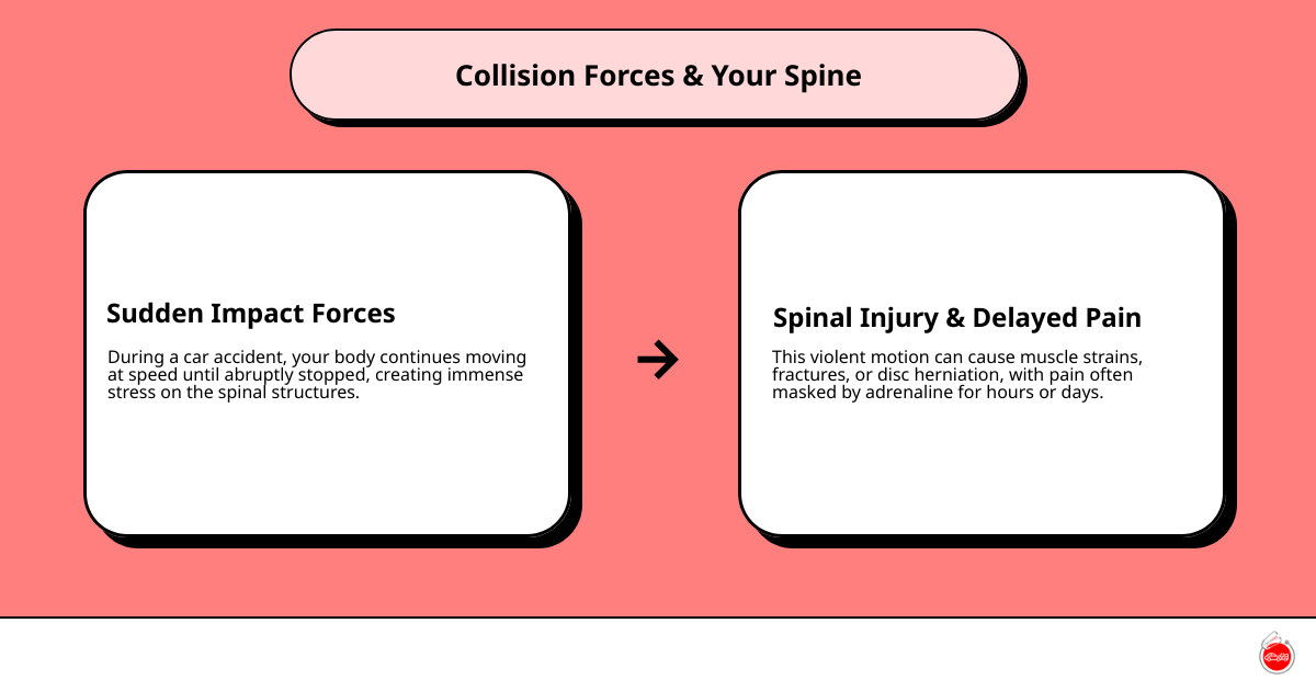 infographic showing how collision forces affect the spine, including impact direction, common injury locations in lumbar and thoracic regions, and the timeline of symptom onset from immediate to delayed - Back pain after accident infographic cause_effect_text