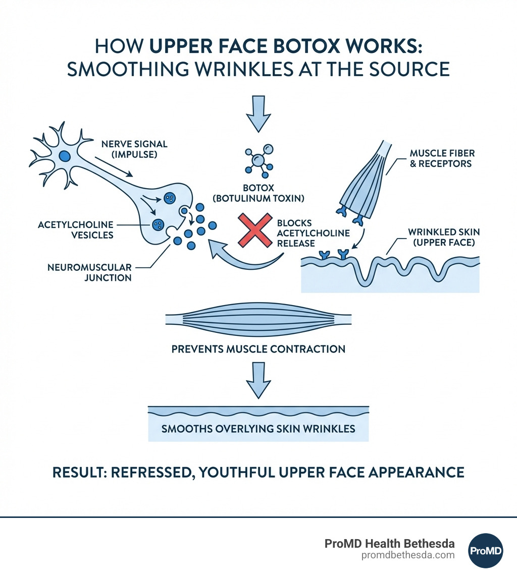 infographic showing how botox blocks acetylcholine release at neuromuscular junction, preventing muscle contraction and smoothing overlying skin wrinkles in the upper face - Upper face Botox infographic 
