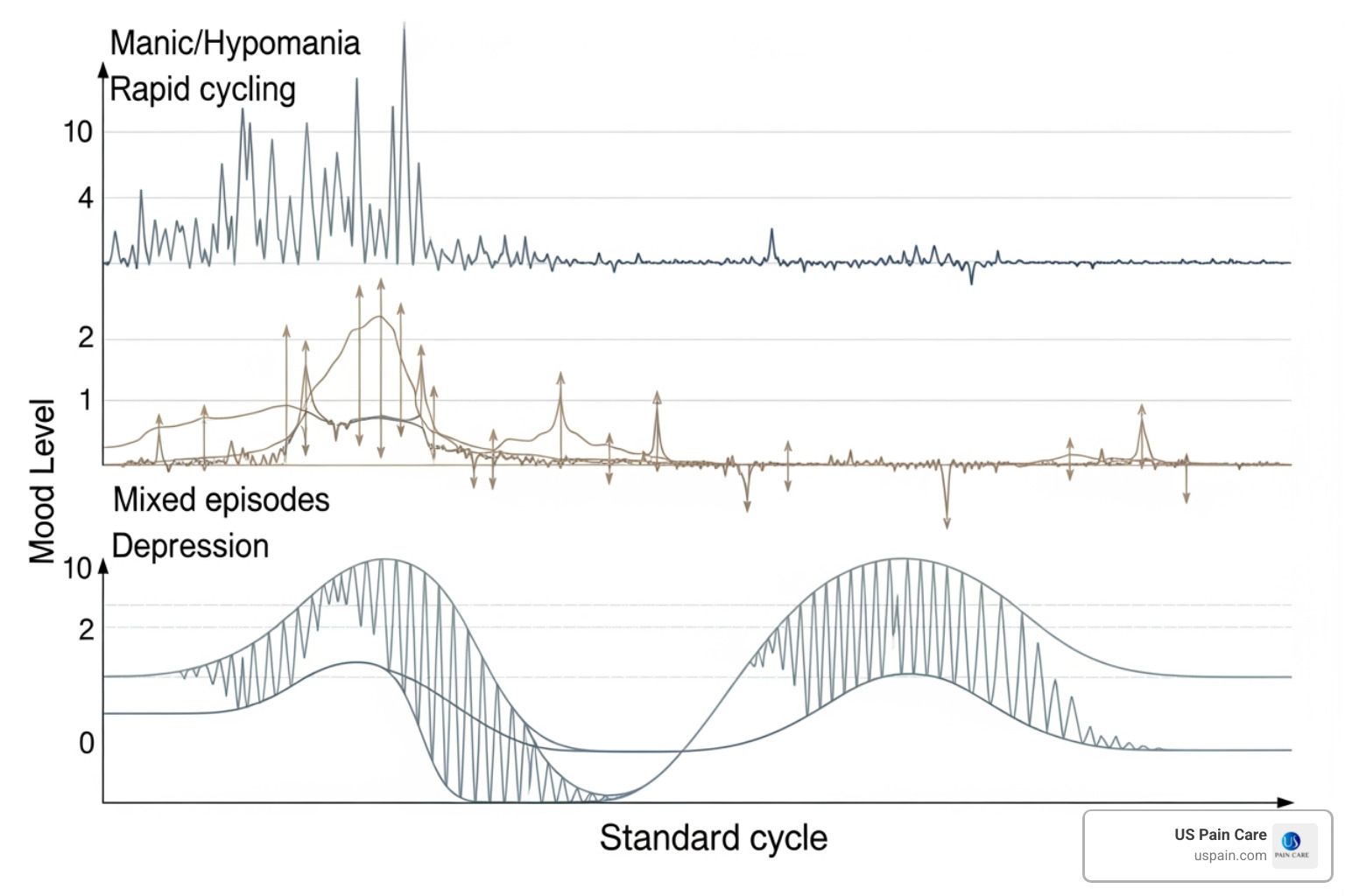 Graphic showing different types of bipolar cycles including rapid cycling and mixed episodes - manic depression