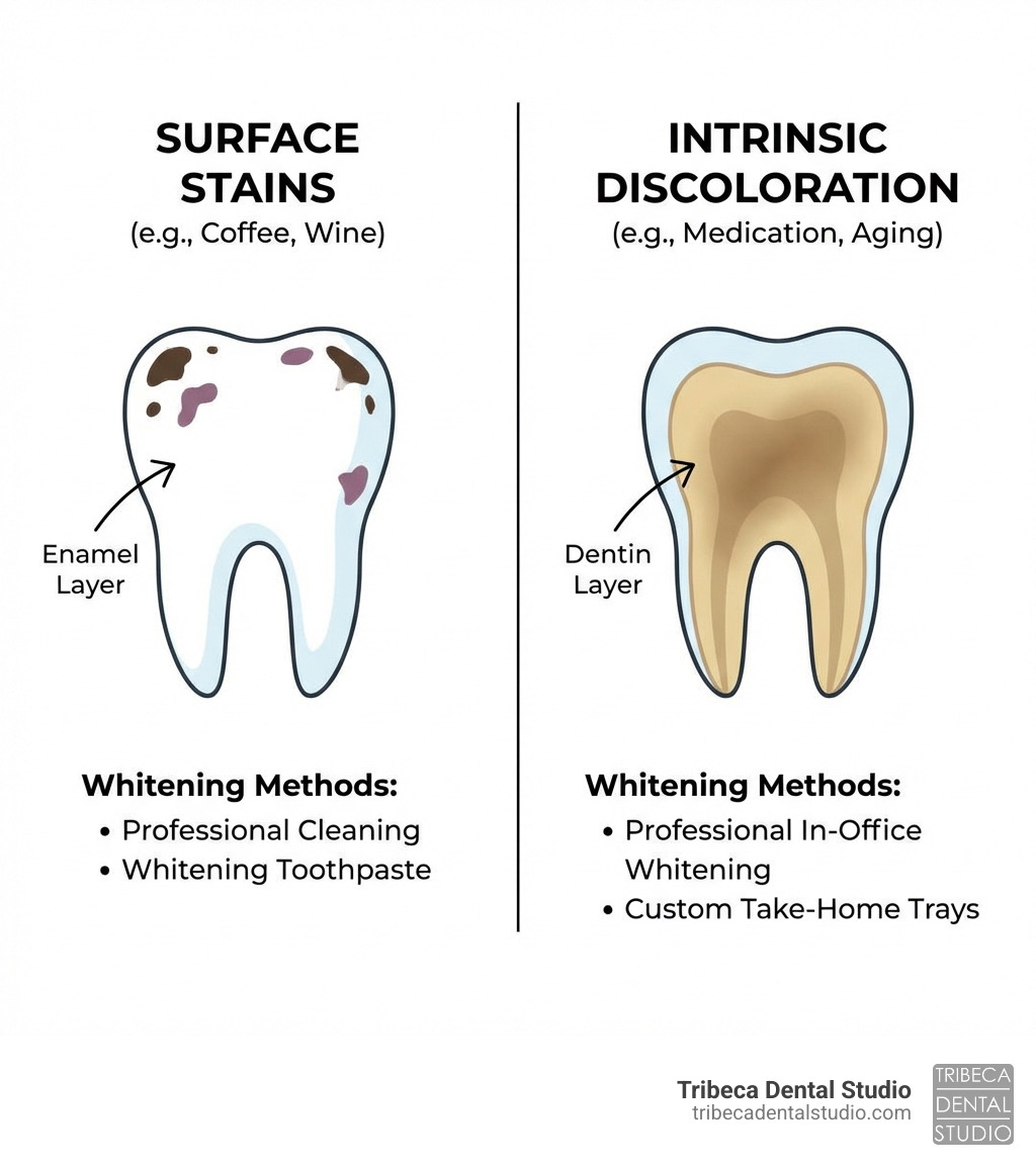 infographic showing the difference between surface stains from coffee and wine versus intrinsic discoloration from medication or aging, with arrows pointing to enamel layer and dentin layer, and notes on which whitening methods work best for each type - professional teeth whitening for sensitive teeth infographic 