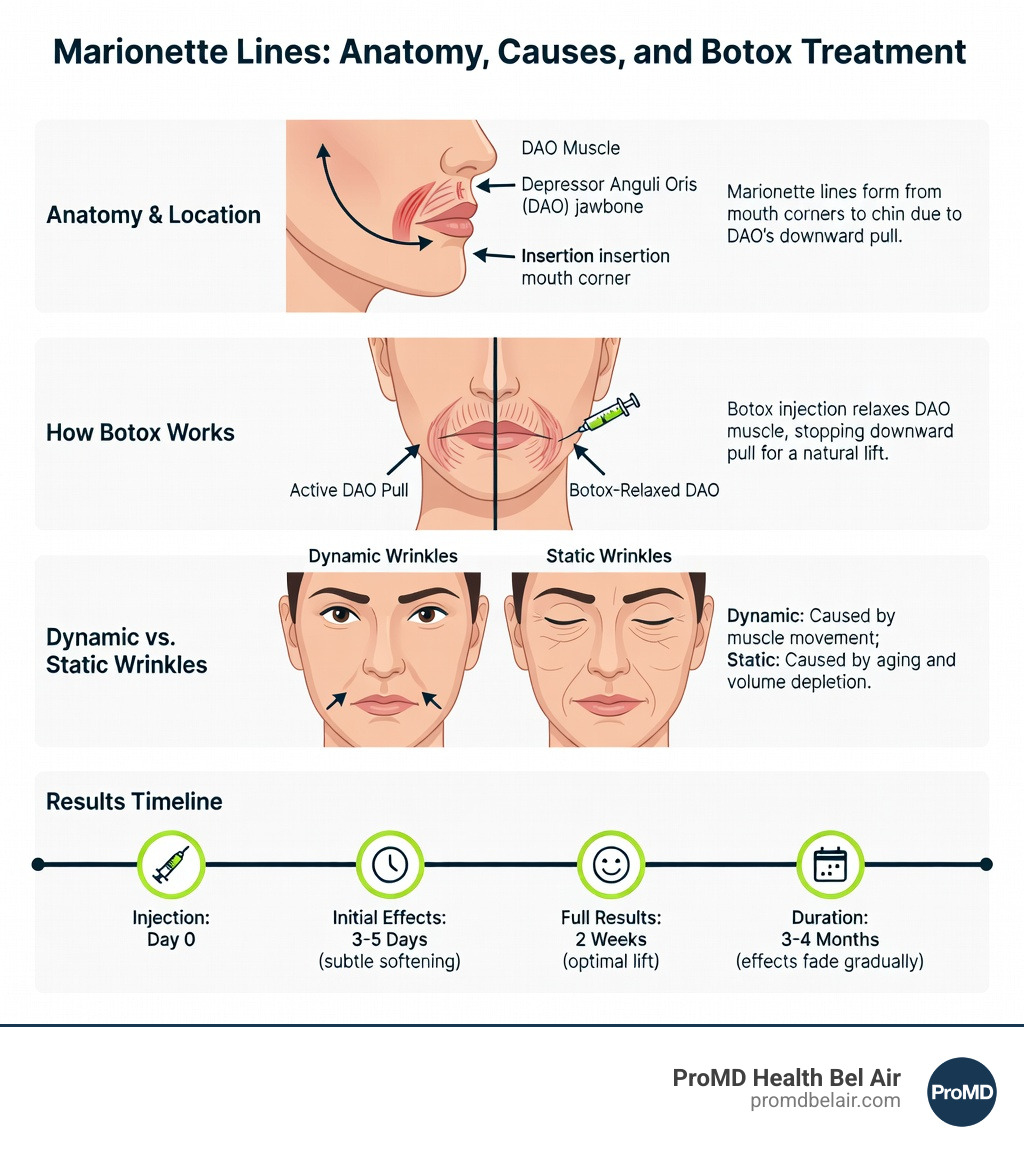 Infographic showing marionette lines anatomy: location from mouth corners to chin, the DAO muscle's downward pull on mouth corners, how Botox relaxes this muscle to lift the area, comparison of dynamic vs static wrinkle causes, and timeline from injection to full results at 2 weeks lasting 3-4 months - marionette lines botox infographic 