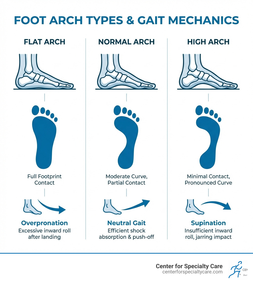 infographic showing three foot arch types: flat arch with full footprint contact, normal arch with moderate curve and partial contact, and high arch with minimal contact and pronounced curve, plus indicators for overpronation, neutral gait, and supination - foot arch support infographic 