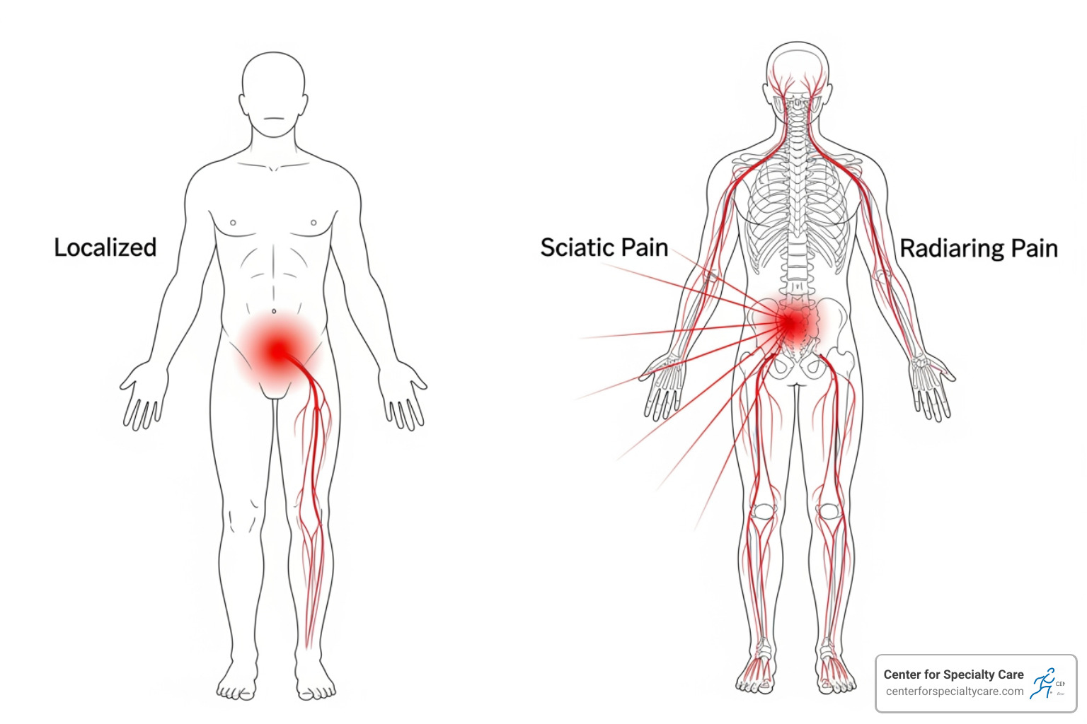 Difference between localized and radiating pain - Pain management Minnesota