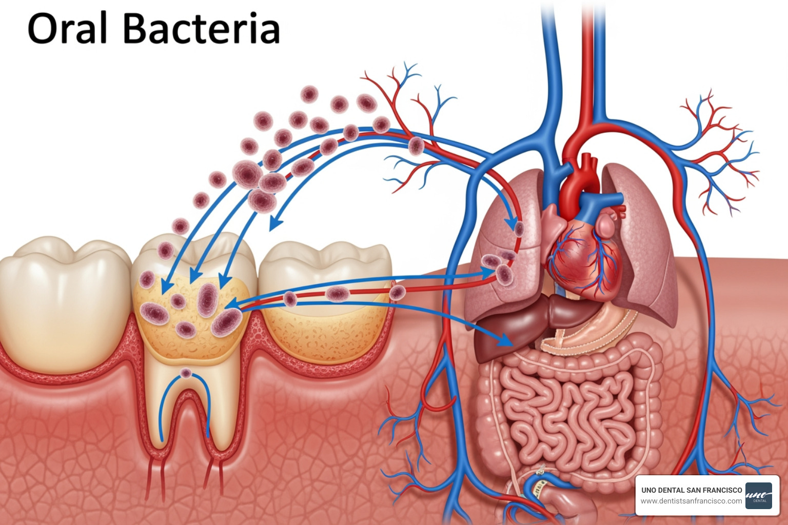 Graphic illustrating oral bacteria entering the bloodstream through inflamed gum tissue, showing the connection between dental plaque and systemic organs like the heart and lungs Graphic illustrating oral bacteria entering the bloodstream through inflamed gum tissue, showing the connection between dental plaque and systemic organs like the heart and lungs