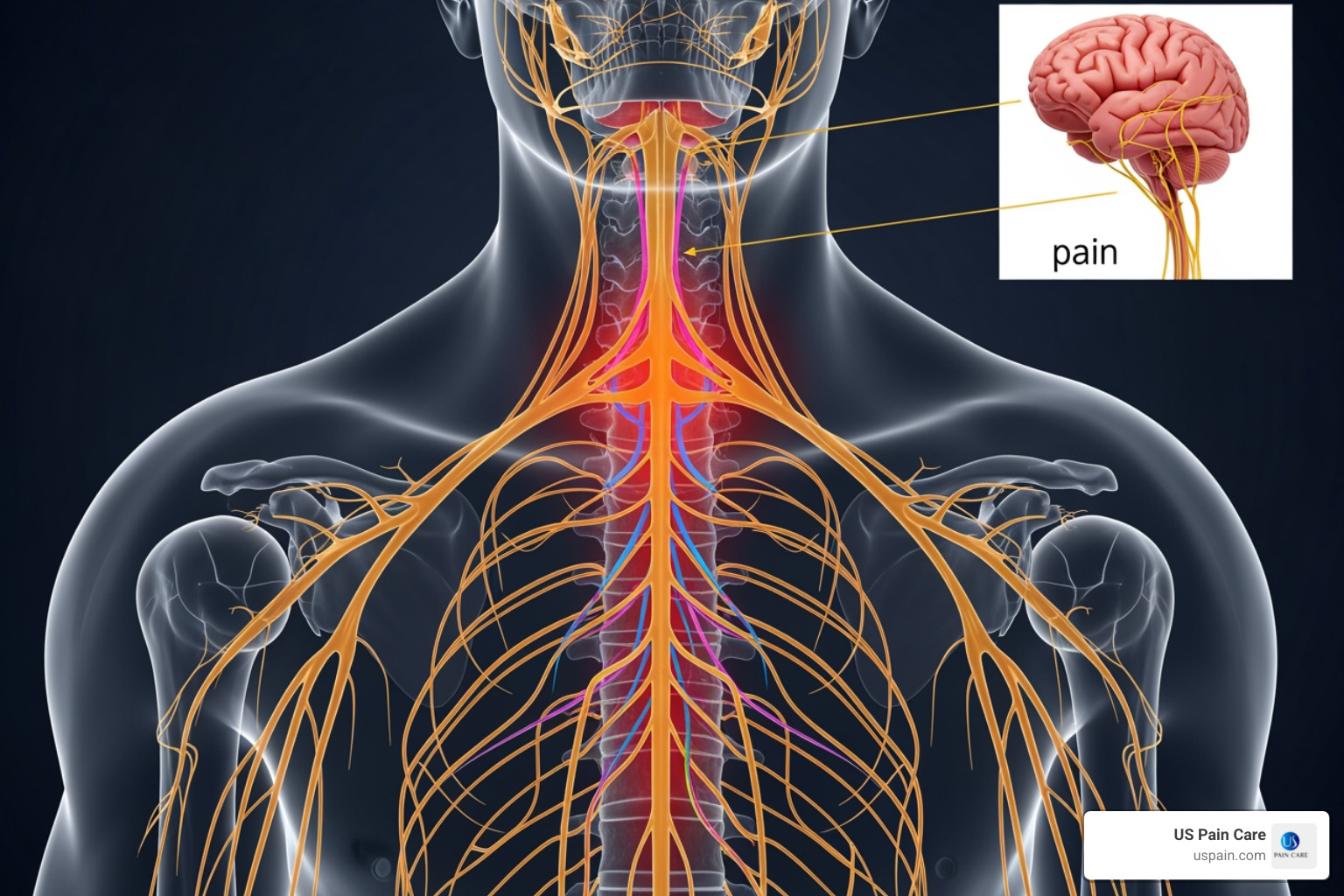 human nervous system showing pain pathways from nerves to brain - pain management patient education