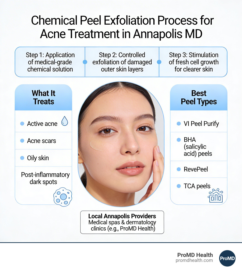 Infographic explaining the chemical peel exfoliation process for acne treatment in Annapolis MD - chemical peel for acne Infographic explaining the chemical peel exfoliation process for acne treatment in Annapolis MD - chemical peel for acne