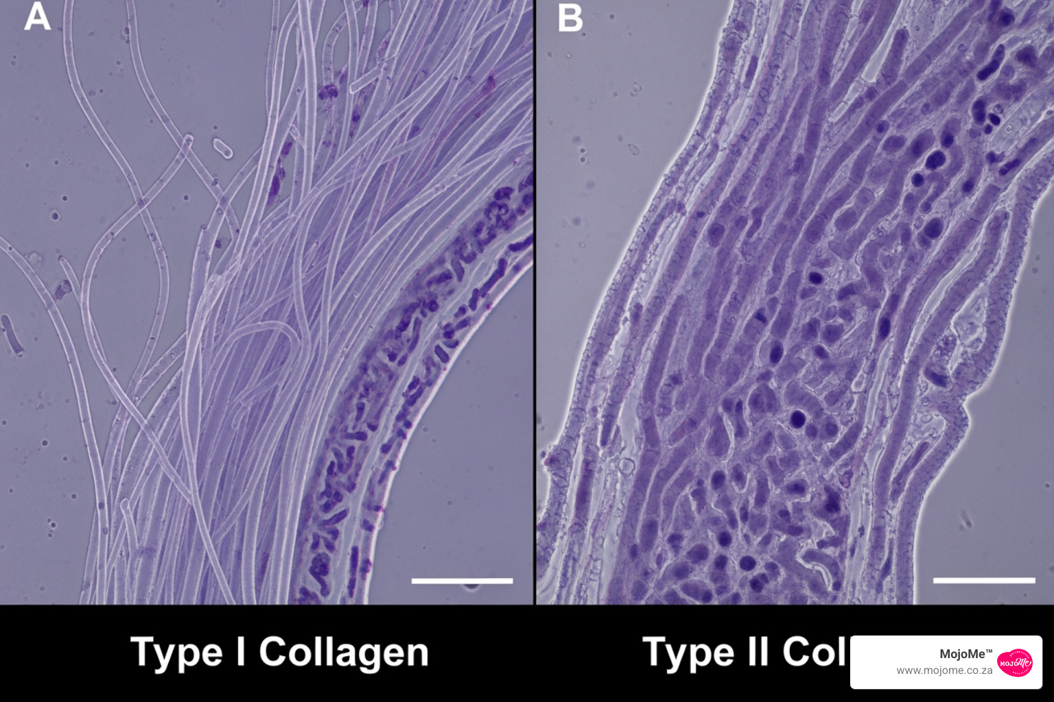Microscopic view showing the difference between Type I and Type II collagen fibers - collagen supplements and arthritis