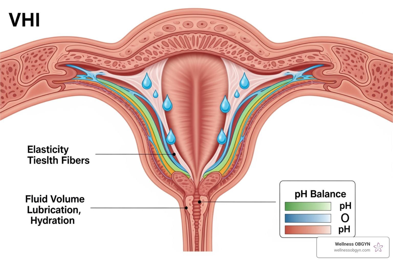 Illustration of Vaginal Health Index (VHI) factors including elasticity, fluid volume, and pH - laser therapy for menopause