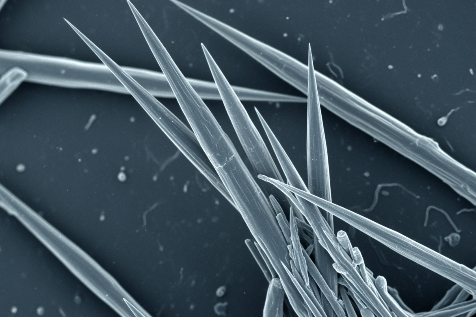 Microscopic view of hazardous asbestos fibers showing needle-like structures - Building asbestos survey