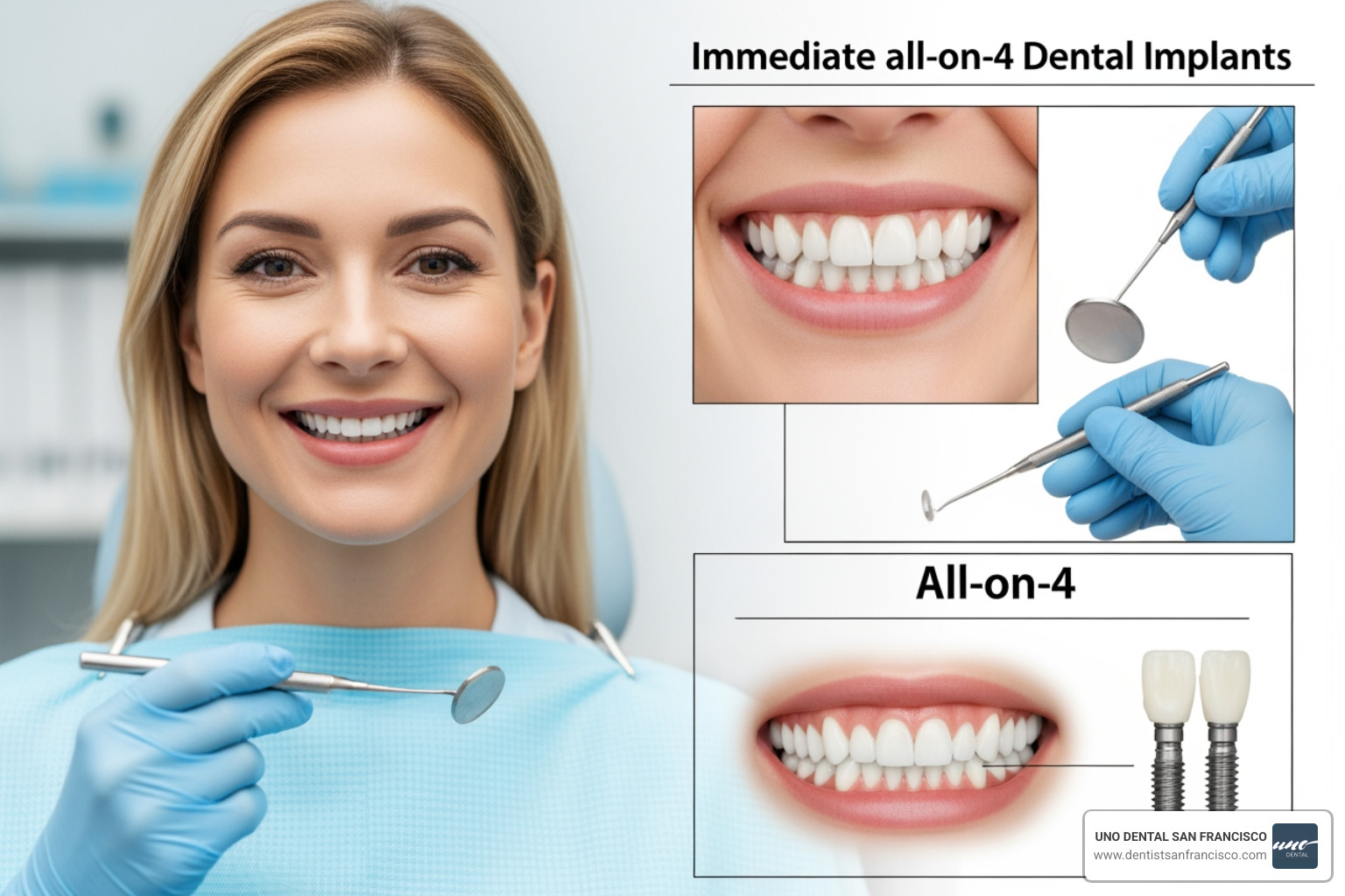 3D digital treatment planning interface showing virtual implant placement - immediate all on 4 dental implants 3D digital treatment planning interface showing virtual implant placement - immediate all on 4 dental implants