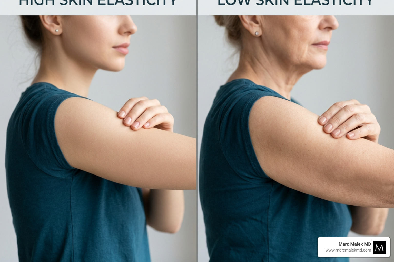 Graphic showing the difference between a patient with high skin elasticity vs low skin elasticity - brachioplasty arm lift Graphic showing the difference between a patient with high skin elasticity vs low skin elasticity - brachioplasty arm lift