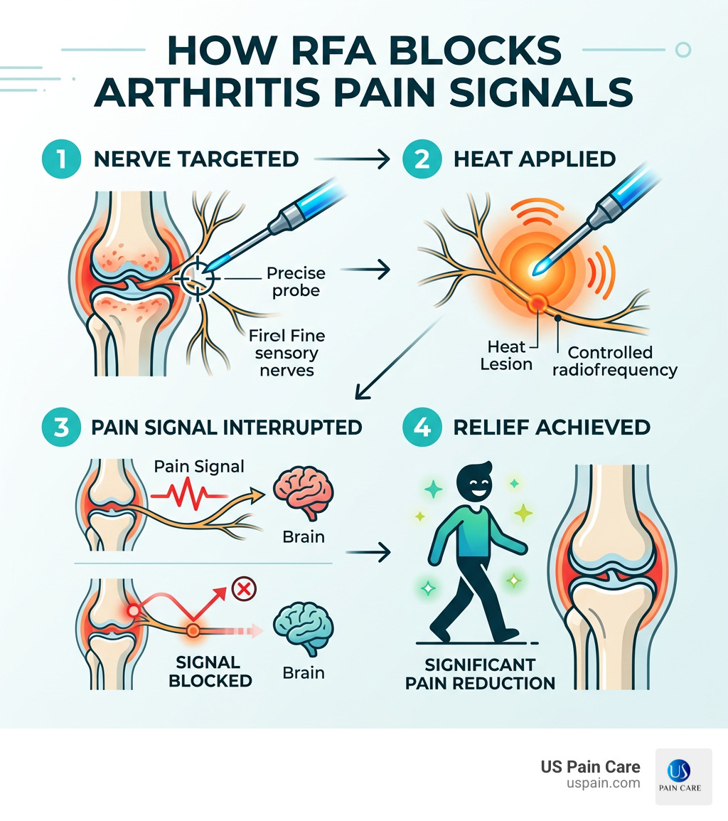 Infographic showing how RFA blocks arthritis pain signals: nerve targeted, heat applied, pain signal interrupted, relief