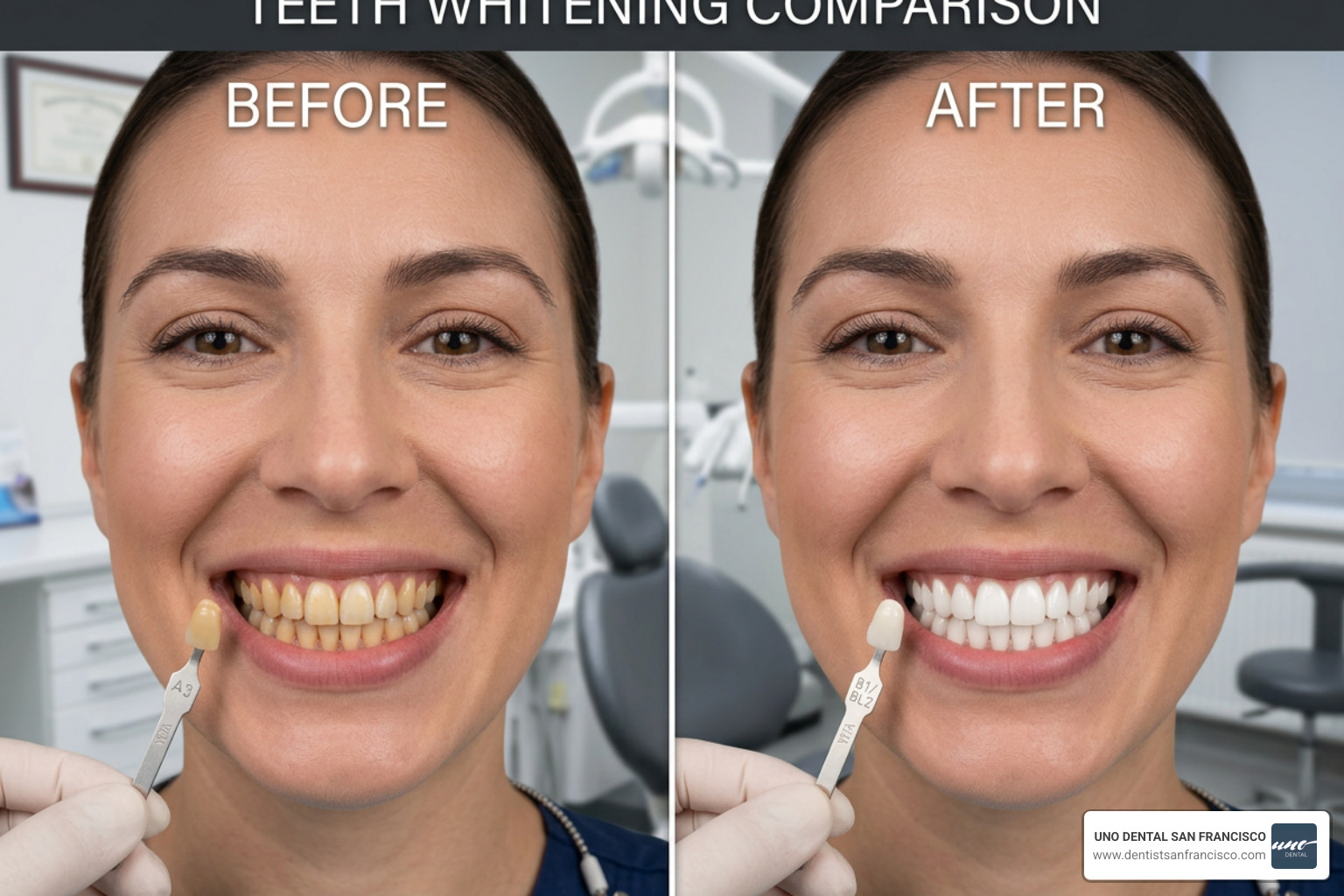 before and after teeth whitening comparison - walk in teeth whitening before and after teeth whitening comparison - walk in teeth whitening