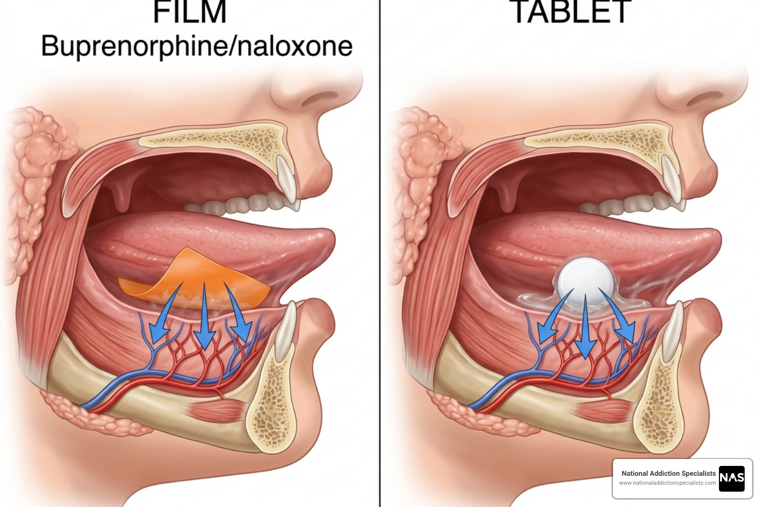 Comparison of sublingual film vs tablet administration - buprenorphine and naloxone sublingual Comparison of sublingual film vs tablet administration - buprenorphine and naloxone sublingual