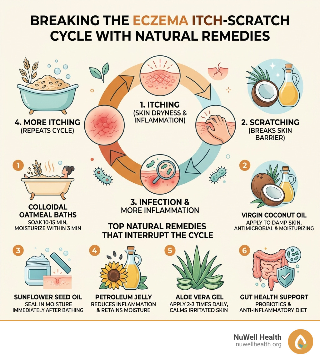 Infographic showing the eczema itch-scratch cycle and top natural remedies that interrupt it - natural ways to heal eczema