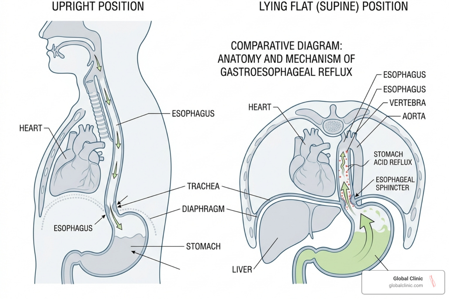 diagram illustrating the proximity of the heart to the esophagus and how lying down affects both - chest pressure when lying diagram illustrating the proximity of the heart to the esophagus and how lying down affects both - chest pressure when lying