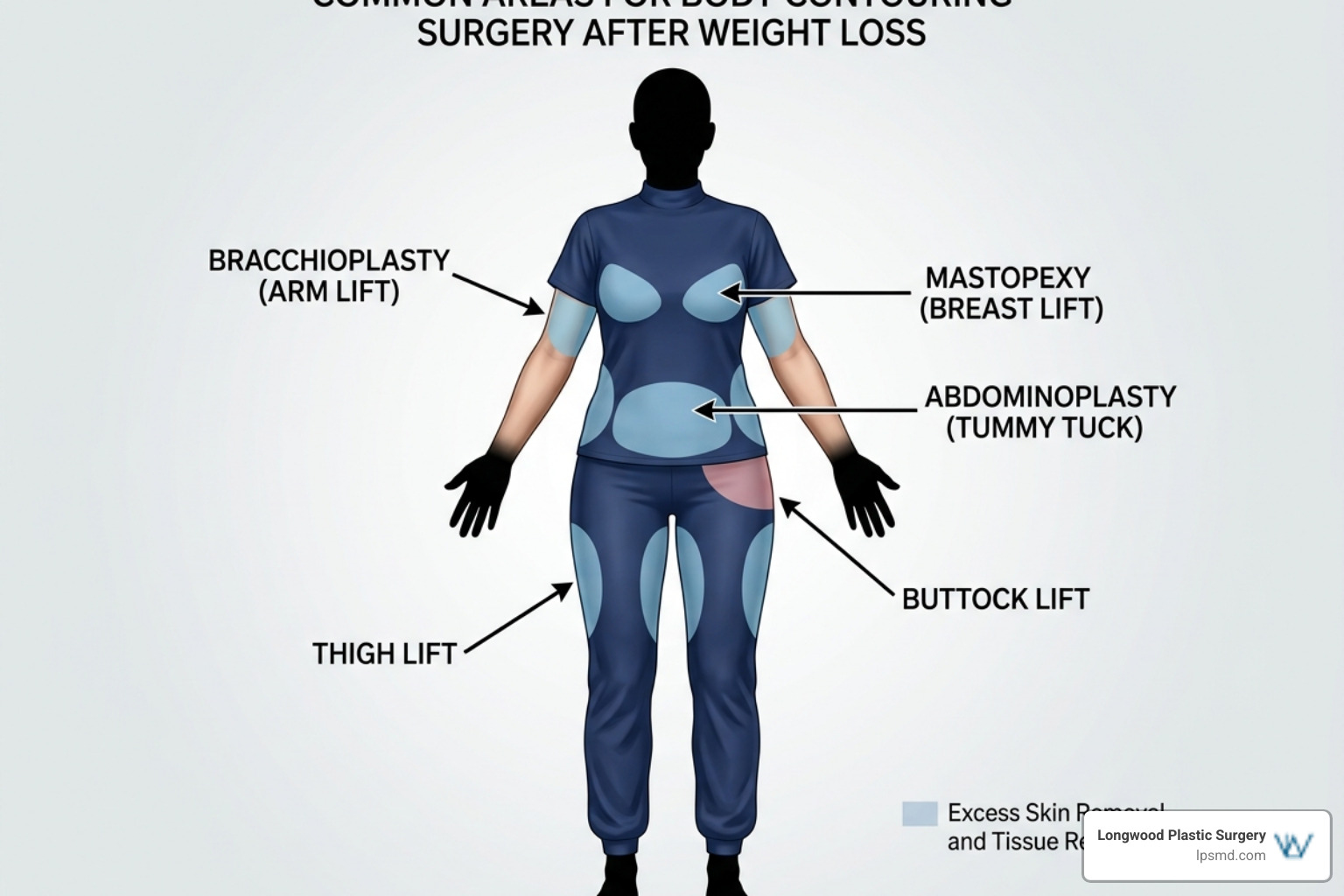 Graphic showing target areas for skin removal including arms, breasts, abdomen, and thighs Graphic showing target areas for skin removal including arms, breasts, abdomen, and thighs