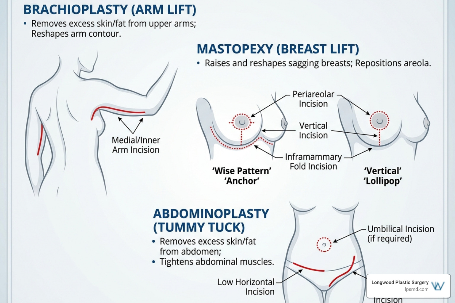 Illustration showing common incision placements for arm lifts, breast lifts, and tummy tucks Illustration showing common incision placements for arm lifts, breast lifts, and tummy tucks