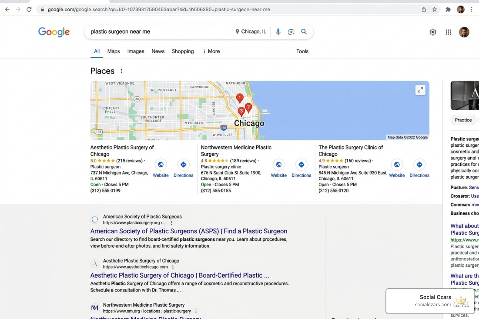 Google Search results page showing plastic surgery rankings Google Search results page showing plastic surgery rankings
