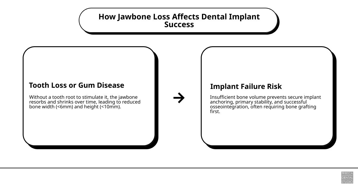 Infographic showing how jawbone loss affects dental implant success and when bone grafting is needed infographic