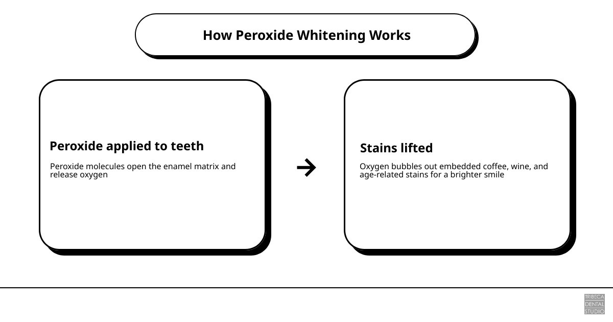 Infographic showing how peroxide whitening works: peroxide opens enamel matrix, oxygen bubbles lift stains, matrix closes Infographic showing how peroxide whitening works: peroxide opens enamel matrix, oxygen bubbles lift stains, matrix closes