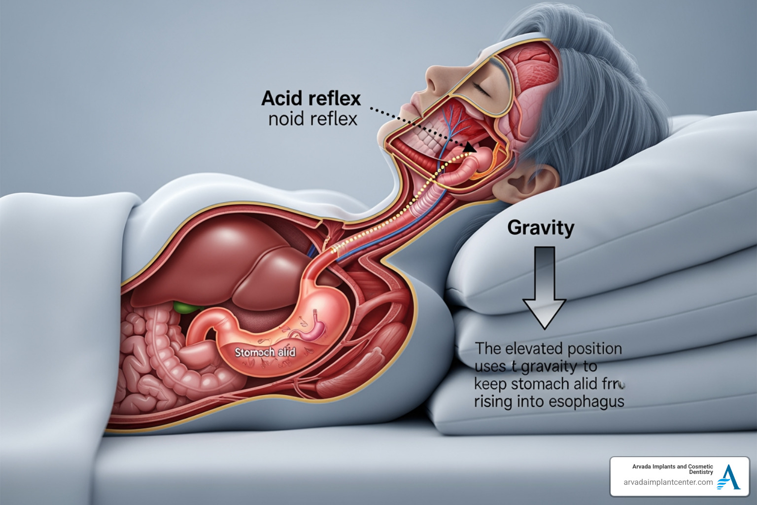 diagram showing digestive alignment and acid reflux prevention in an elevated position