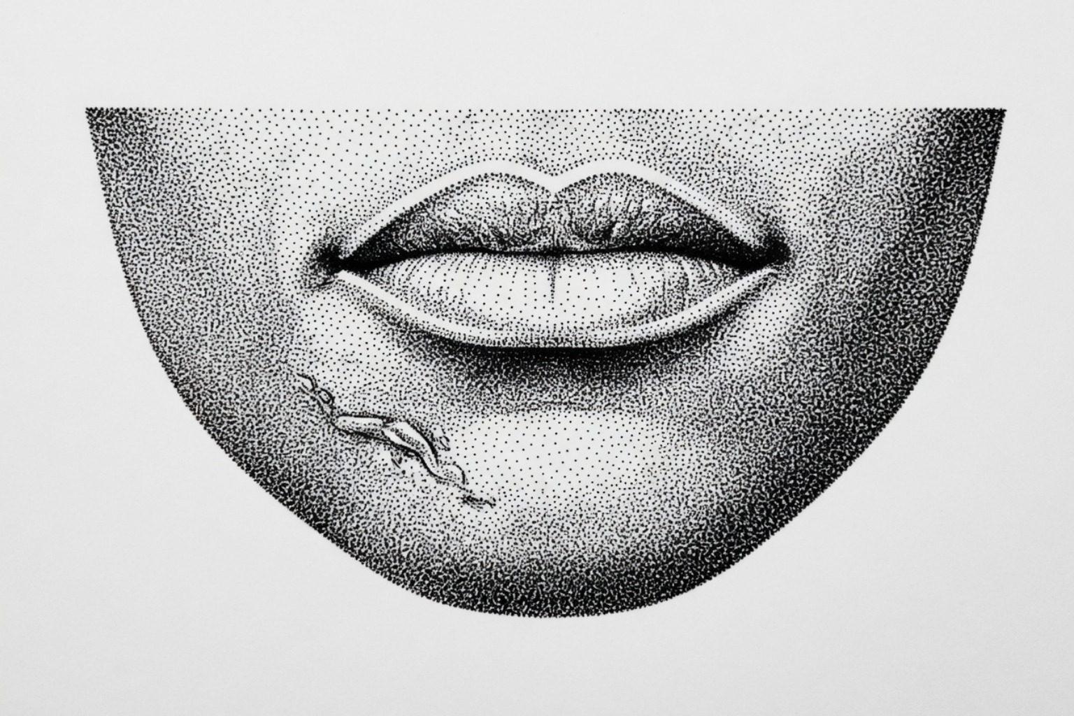 illustration of a keloid on dark skin - keloid causes illustration of a keloid on dark skin - keloid causes