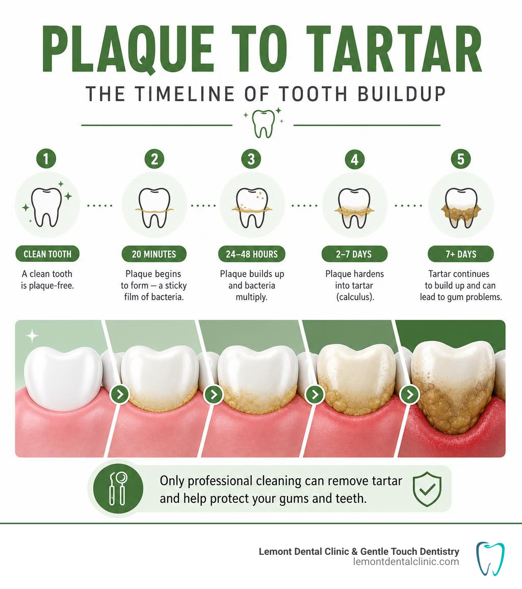 Plaque to tartar timeline infographic showing how plaque forms and hardens into tartar over time infographic
