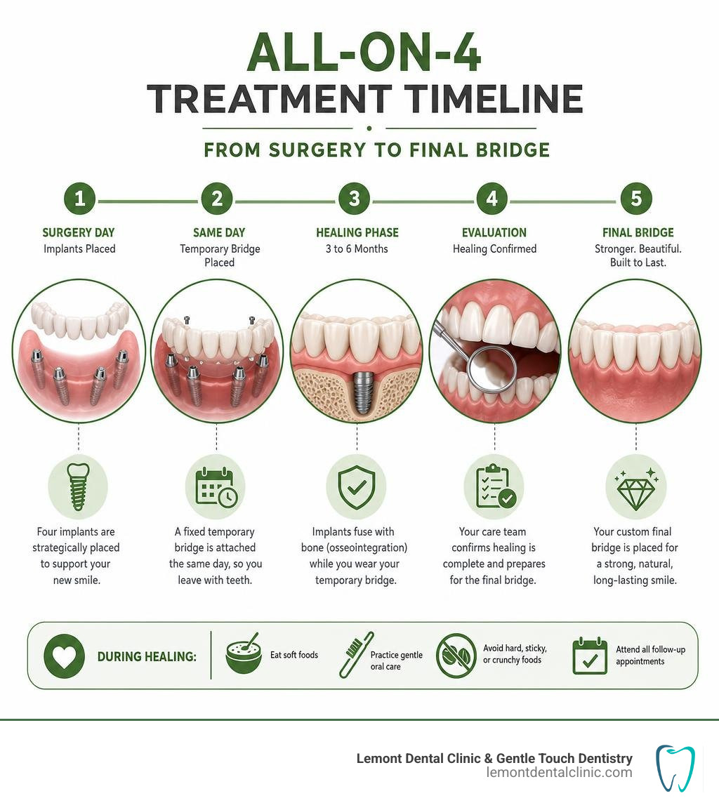 All-on-4 treatment timeline from surgery to final bridge infographic infographic All-on-4 treatment timeline from surgery to final bridge infographic infographic