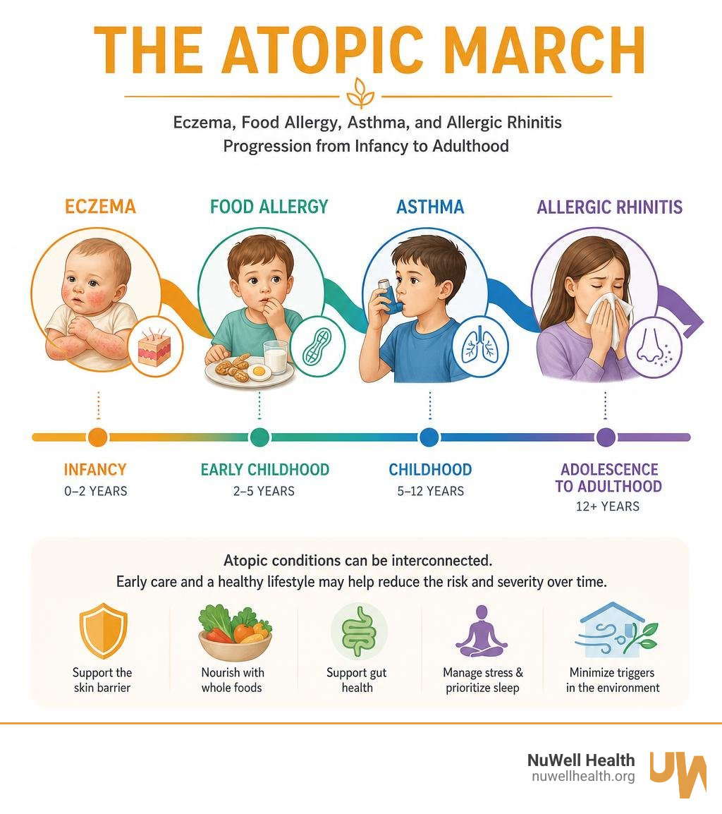 The atopic march: eczema, food allergy, asthma, and allergic rhinitis progression from infancy to adulthood infographic The atopic march: eczema, food allergy, asthma, and allergic rhinitis progression from infancy to adulthood infographic