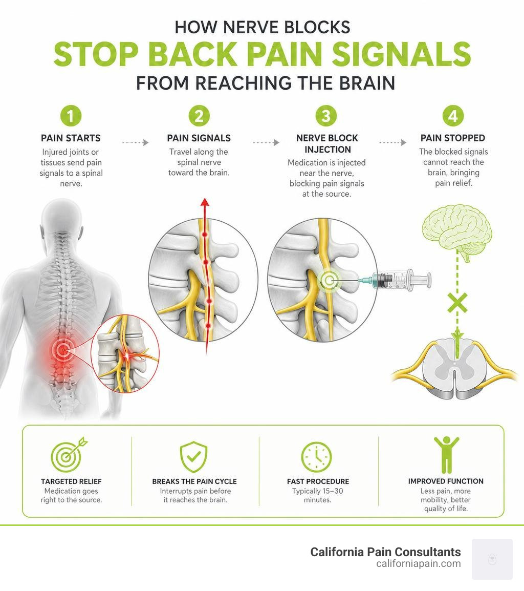 Infographic showing how nerve blocks stop back pain signals from reaching the brain infographic