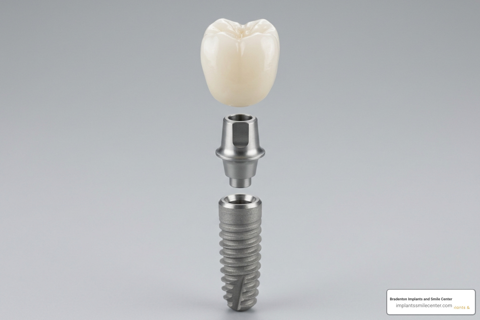 Three parts of a dental implant: post, abutment, and crown Three parts of a dental implant: post, abutment, and crown