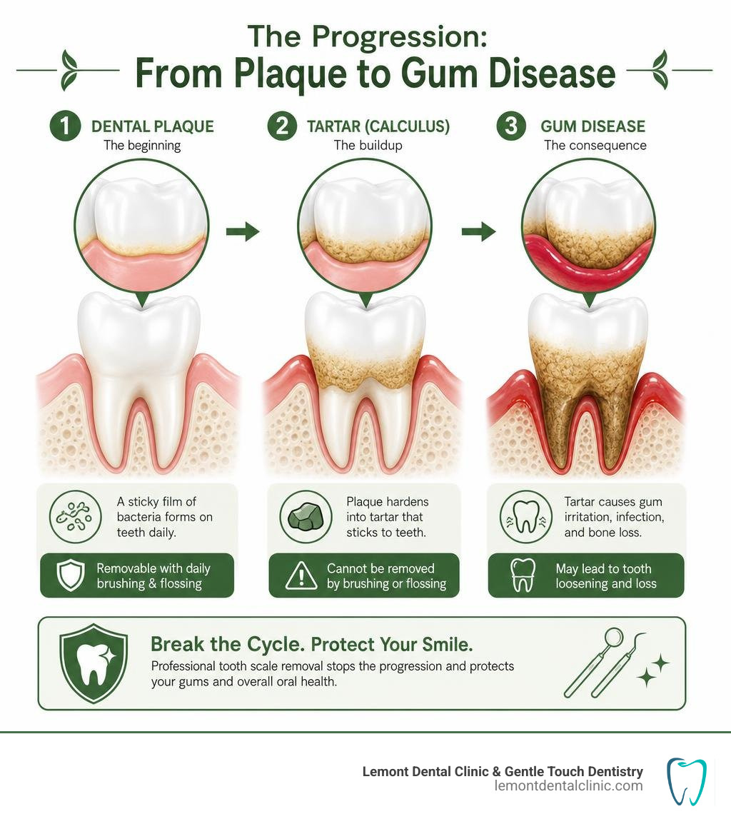 Infographic showing progression from dental plaque to tartar to gum disease stages infographic