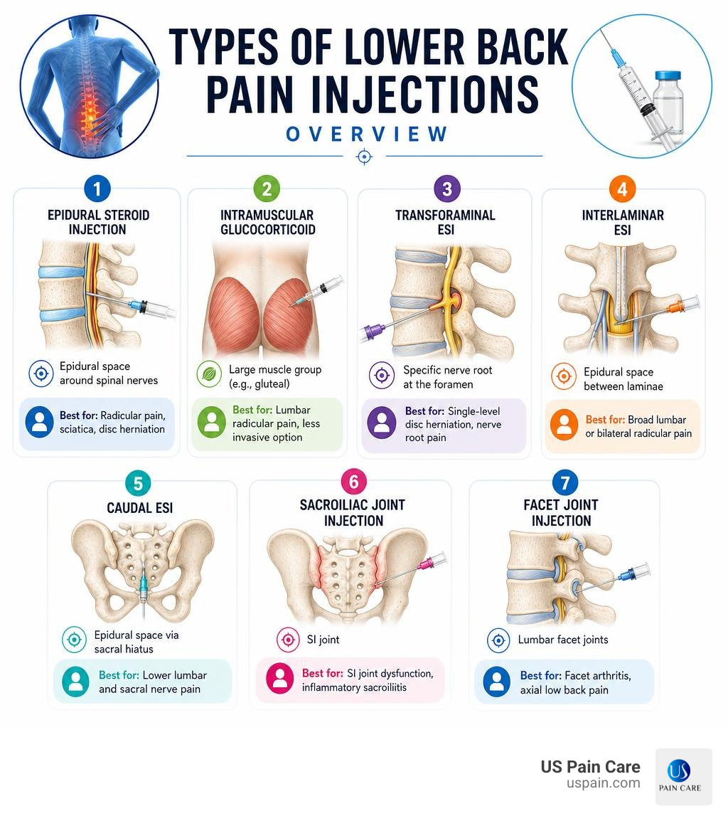 Types of lower back pain injections overview infographic infographic