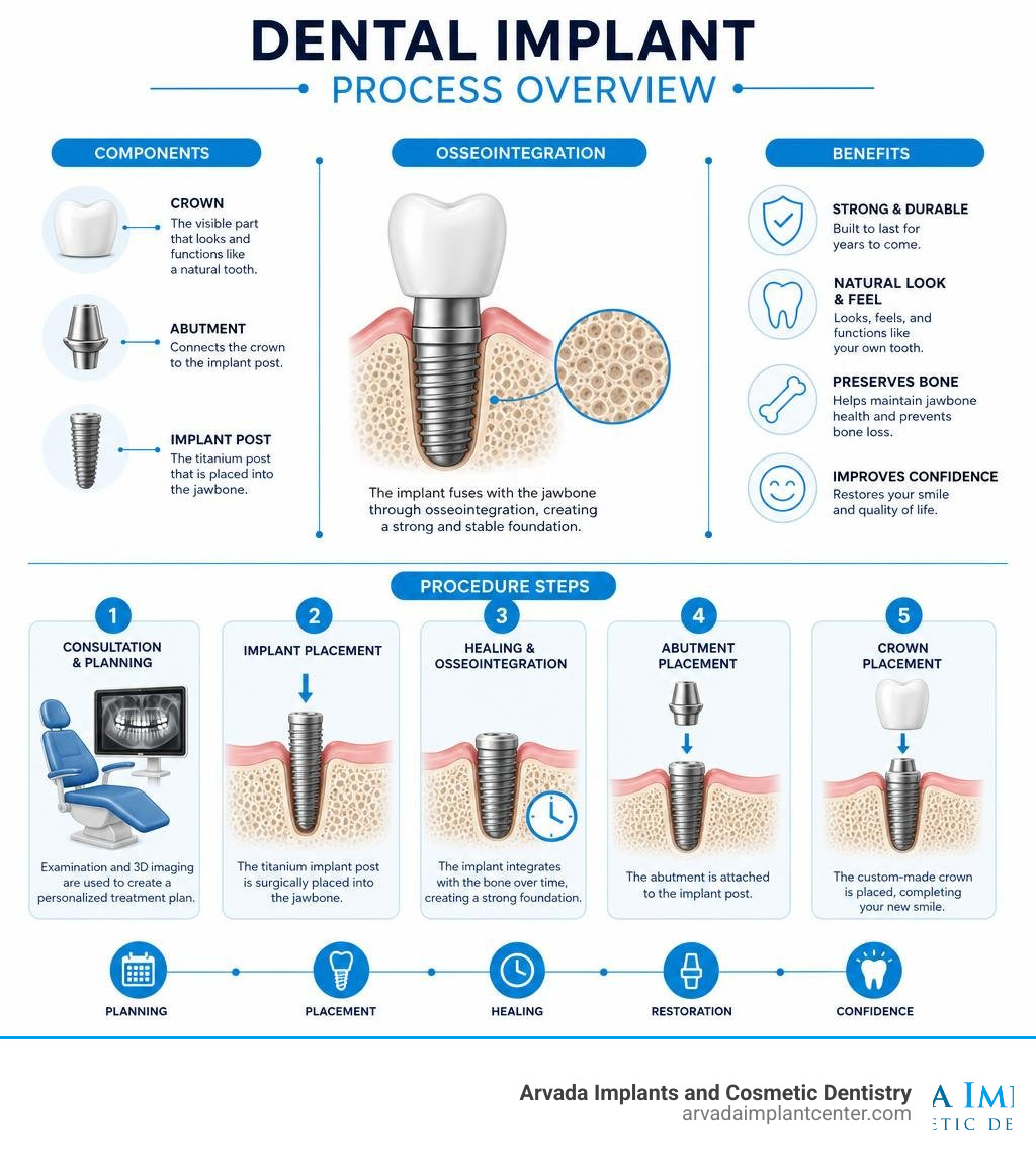 Dental implant process overview infographic: components, osseointegration, and procedure steps infographic Dental implant process overview infographic: components, osseointegration, and procedure steps infographic